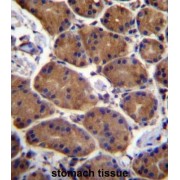 Aspartate Beta Hydroxylase (ASPH) Antibody