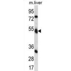 Fukutin (FKTN) Antibody