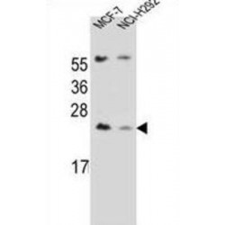 Vertebrate Lin-7 Homolog 3 (LIN7C) Antibody