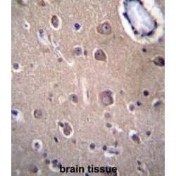 Solute Carrier Family 8 Member A3 (SLC8A3) Antibody