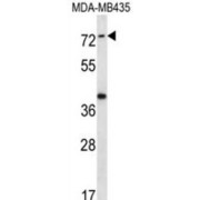 WB analysis of extracts of MDA-MB435 cell line lysates (35 µg/lane), using SYTL1 Antibody.