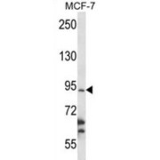 RNA Binding Motif Protein 28 (RBM28) Antibody