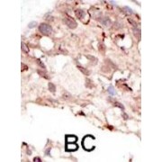 Suppressor of Variegation 3-9 Homolog 2 (SUV39H2) Antibody
