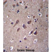 Phosphatase And Actin Regulator 3 (PHACTR3) Antibody