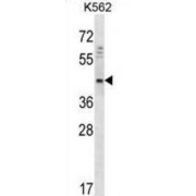 WB analysis of K562 cell line lysate (35 µg/ml), using DOC2A antibody.