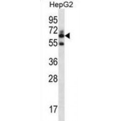 Gamma-Glutamyltransferase 2 (GGT2) Antibody