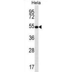 Schwannomin-Interacting Protein 1 (SCHIP1) Antibody