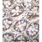 Ladinin 1 (LAD1) Antibody