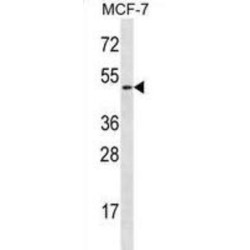 Ladinin 1 (LAD1) Antibody