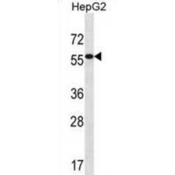 Aldehyde Dehydrogenase 3 Family Member B2 (ALDH3B2) Antibody