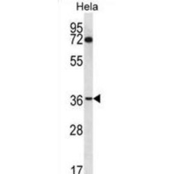 Nucleoporin 35 (NUP35) Antibody