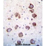 Pro-Epidermal Growth Factor (EGF) Antibody