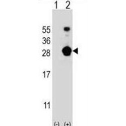 FK506 Binding Protein 7 (FKBP7) Antibody