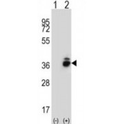 Corticotropin Releasing Hormone Bingding Protein (CRHBP) Antibody