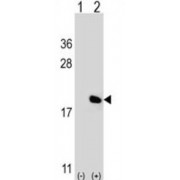Interleukin 17A (IL17A) Antibody