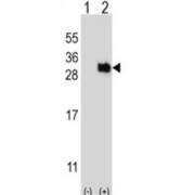 Ubiquitin Domain Containing 1 (UBTD1) Antibody