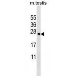 Transmembrane Protein 18 (TMM18) Antibody