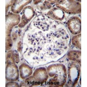 Vacuolar Protein Sorting-Associated Protein 54 Homolog (VPS54) Antibody