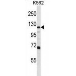 Glutamate Receptor, Ionotropic, AMPA 1 (GRIA4) Antibody