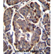 RAB11B, Member RAS Oncogene Family (RAB11B) Antibody