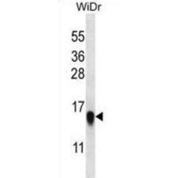 Ribosomal Protein L35 (RPL35) Antibody