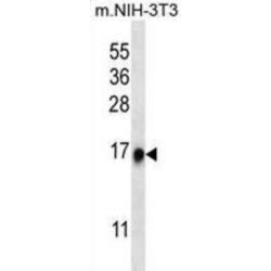 Ribosomal Protein L35 (RPL35) Antibody
