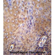 Solute Carrier Family 6 Member 14 (SLC6A14) Antibody