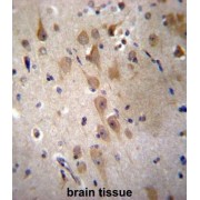 Glutamate Receptor-Interacting Protein 2 (GRIP2) Antibody