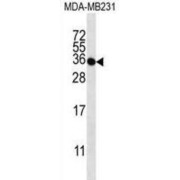 Taste 2 Receptor Member 1 (TAS2R1) Antibody