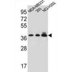 Taste 2 Receptor Member 1 (TAS2R1) Antibody