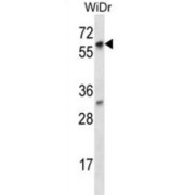La Ribonucleoprotein Domain Family, Member 7 (LARP7) Antibody
