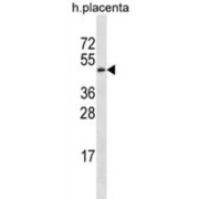 Galactose-3-O-Sulfotransferase 4 (GAL3ST4) Antibody