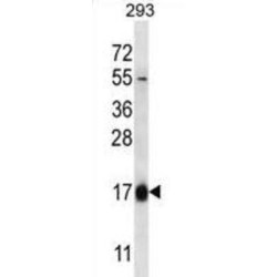 Hemoglobin Subunit Theta-1 (HBQ1) Antibody