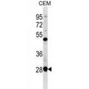 Ribosomal RNA Processing 7 Homolog A (RRP7A) Antibody