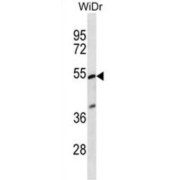 Phosphatidylinositol Glycan Anchor Biosynthesis Class V (PIGV) Antibody