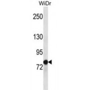 Leucine Zipper Tumor Suppressor 2 (LZTS2) Antibody
