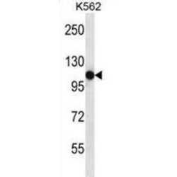 Semaphorin 4C (SEMA4C) Antibody