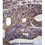 Ubiquinol-Cytochrome C Reductase Binding Protein (UQCRB) Antibody