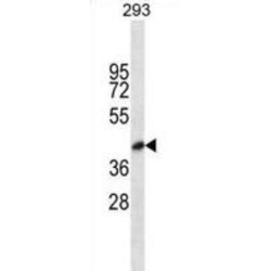 Popeye Domain-Containing Protein 1 (POPDC1) Antibody