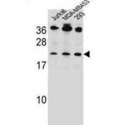 Bak (BH3 Domain Specific) Antibody