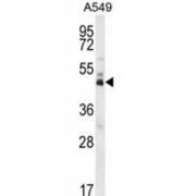 Double Homeobox Protein 4 (DUX4) Antibody