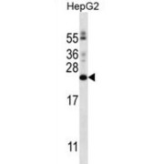 Phosphatidylinositol Glycan Anchor Biosynthesis Class H (PIGH) Antibody