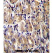 Torsin 1B (TOR1B) Antibody
