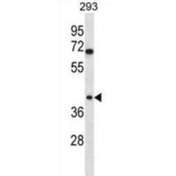 Torsin 1B (TOR1B) Antibody