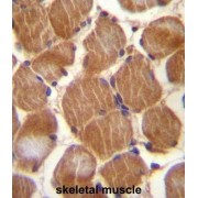 Adipocyte Adhesion Molecule (CLMP) Antibody