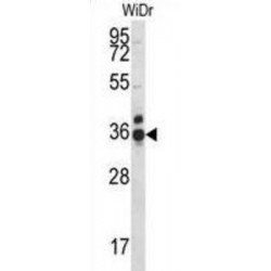 Coiled-Coil Domain-Containing Protein 90B (CCDC90B) Antibody