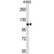 Pleckstrin Homology Domain-Containing Family M Member 1 (PLEKHM1) Antibody