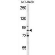 Myeloperoxidase (MPO) Antibody