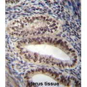 abx027179
