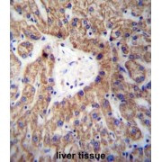 Glycine N-Acyltransferase (GLYAT) Antibody